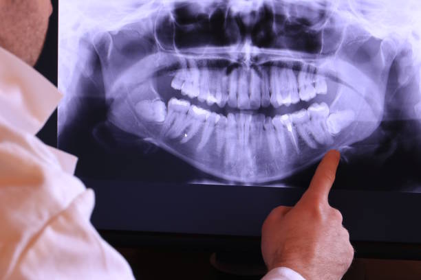 Best Emergency Treatment for Toothache in Slater Marietta, SC